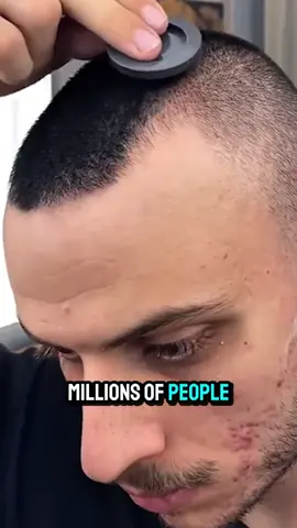 Fellas, fix that hairline in seconds 💪 Buy 1 Get 1 FREE today only! #BOGO #HairShadowPowder #Hairline #Balding