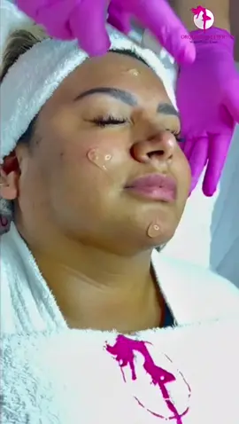 Agenda tu cita hoy mismo en el link de nuestro perfil 🥰💕 #facial #estetica #Virall #exosomas #paratiiiiiiiiiiiiiiiiiiiiiiiiiiiiiii 