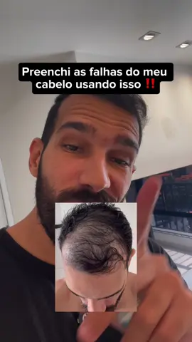 Recupere sua saúde capilar #cabelo #quedadecabelo #cabelosaudavel #crescimentocapilar 