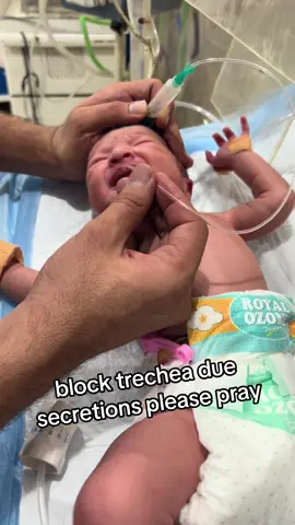 block trechea due to secretions please pray for baby #unitedkingdom🇬🇧 