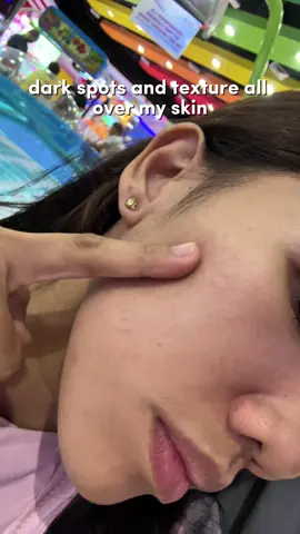 Textured & damaged skin? This got you covered @Dr.Althea US #dralthea#vitamincserum#345cream#moisturzer#serum 