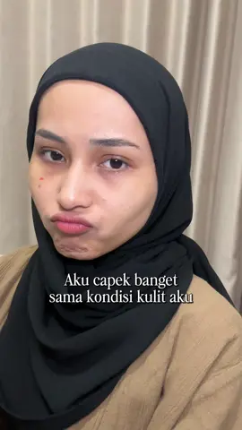 Kulitmu butuh kelembaban dan nutrisi yang tepat untuk cerah dan glowing ✨ #moisturizer #moisturizerviral #skincareroutine #acnetreatment #acneproneskin 