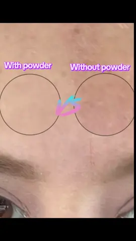 I cant believe i found gold, Lasts the whole day, Under 105 weather maskproof, doesnt cake and it comes with a travel size under 20 dlls ??!   #carslanpowder #bestsettingpowder #hamiltonplay #twinsistersmistakenformotheranddaugther #patricktahighlighter 