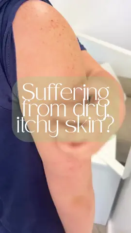 Skin Stuff provides 100% natural relief for dry and itchy skin, soothe redness and soreness and deeply moisturises 🤍🍃 #naturalskincare #plantpower #natureknowsbest #skinstuff #fyp #healthyskin #soothe 