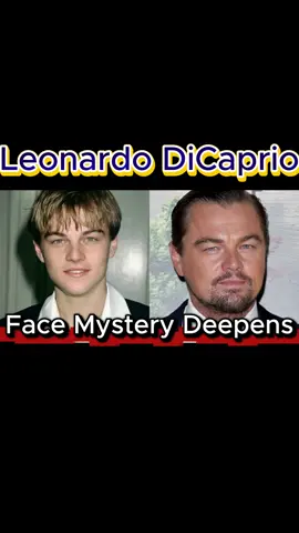 Leonardo DiCaprio has been spotted repeatedly shielding his face from cameras, sparking wild speculation. Rumors swirl that the actor might be concealing visible damage linked to alleged substance use. Is this just privacy-or something far more troubling? The mystery deepens every time Leo steps out in public. #LeonardoDiCaprio #HollywoodSecrets #CelebrityMystery #LeoNews #HollywoodRumors