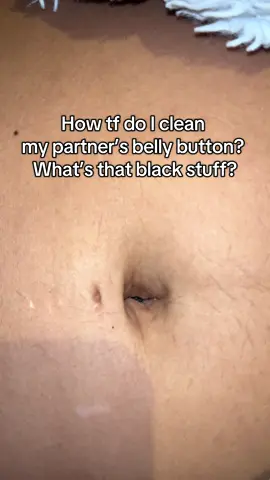 Please help, we honestly don’t lnow what to do 😭 #doctorsoftiktok #bellybutton  #umbilicalcord 