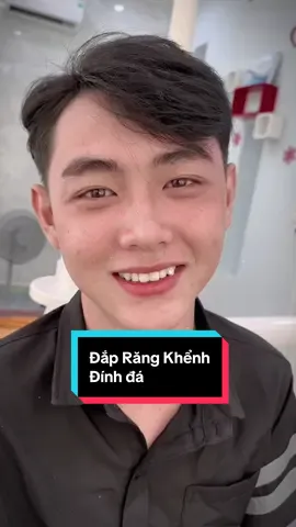 Combo Đắp Răng Khểnh & đính đá cho troai đẹp #HeraDuong #đắp_răng_khểnh #răngkhểnh #trám_răng_composite #nhakhoaquan12 