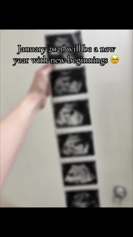 #pregnant #2026baby #pregnancyannouncement 