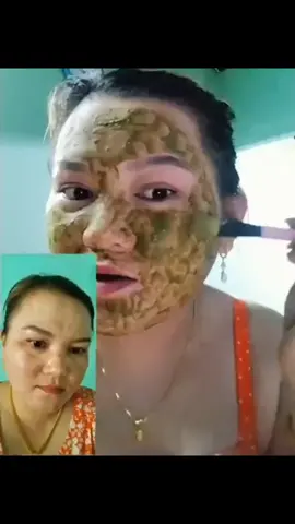 #chữa_nám_tại_nhà_bằng_lá_nam @Em phượng miền tây 🌴🥥 