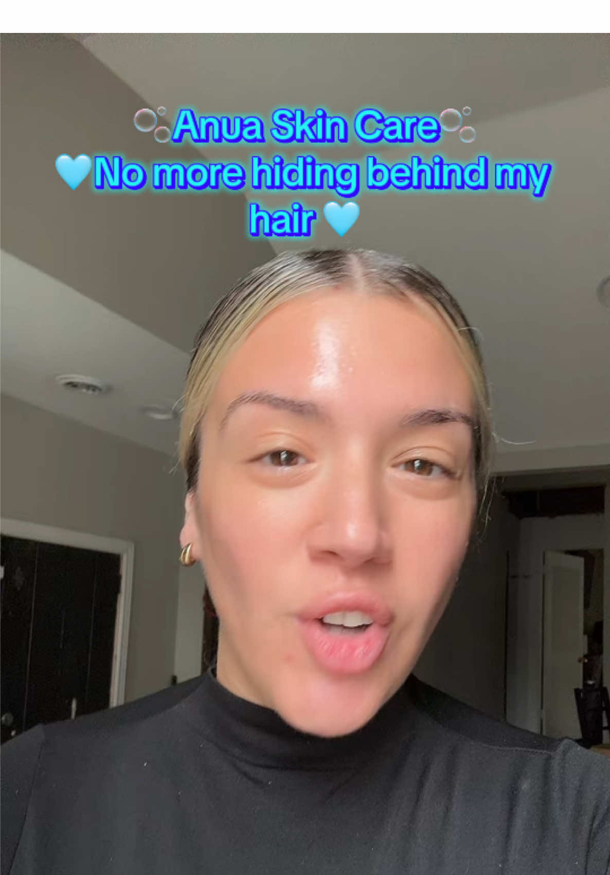 Anua helped me regain my confidence. Textured face,dry lines,large pores no long an issue!!#anua #anuasuperbrandday #anuasuperbrandday #allspotoneserum #anuadarkspotserum 