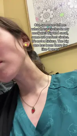 ITS NOT A HICKEY, ITS NEVER BEEN ik yall think that’s what they are 😭 They don’t itch or bother me, they fade and then they come back, why are they perfect circles? I have so many questions #doctor #help 