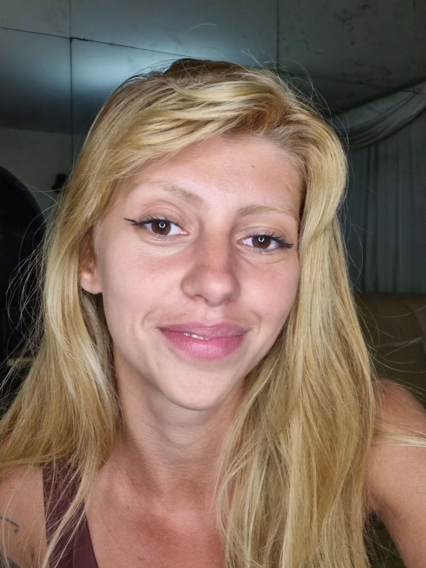 Respondendo a @marcellathais02 acne é emocional!!!! #psicossomatica #acne #skincare #terapia #leidaatração 