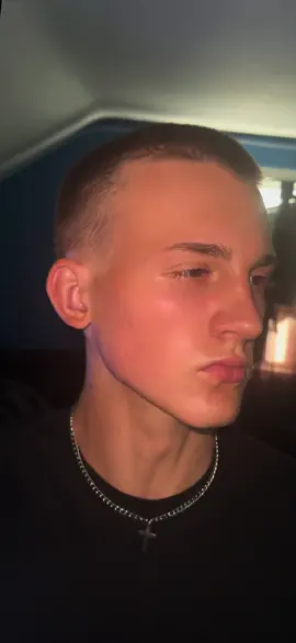 Cute lil pimple 🥰 #looksmax #GlowUp #fyp #viral #fypシ 