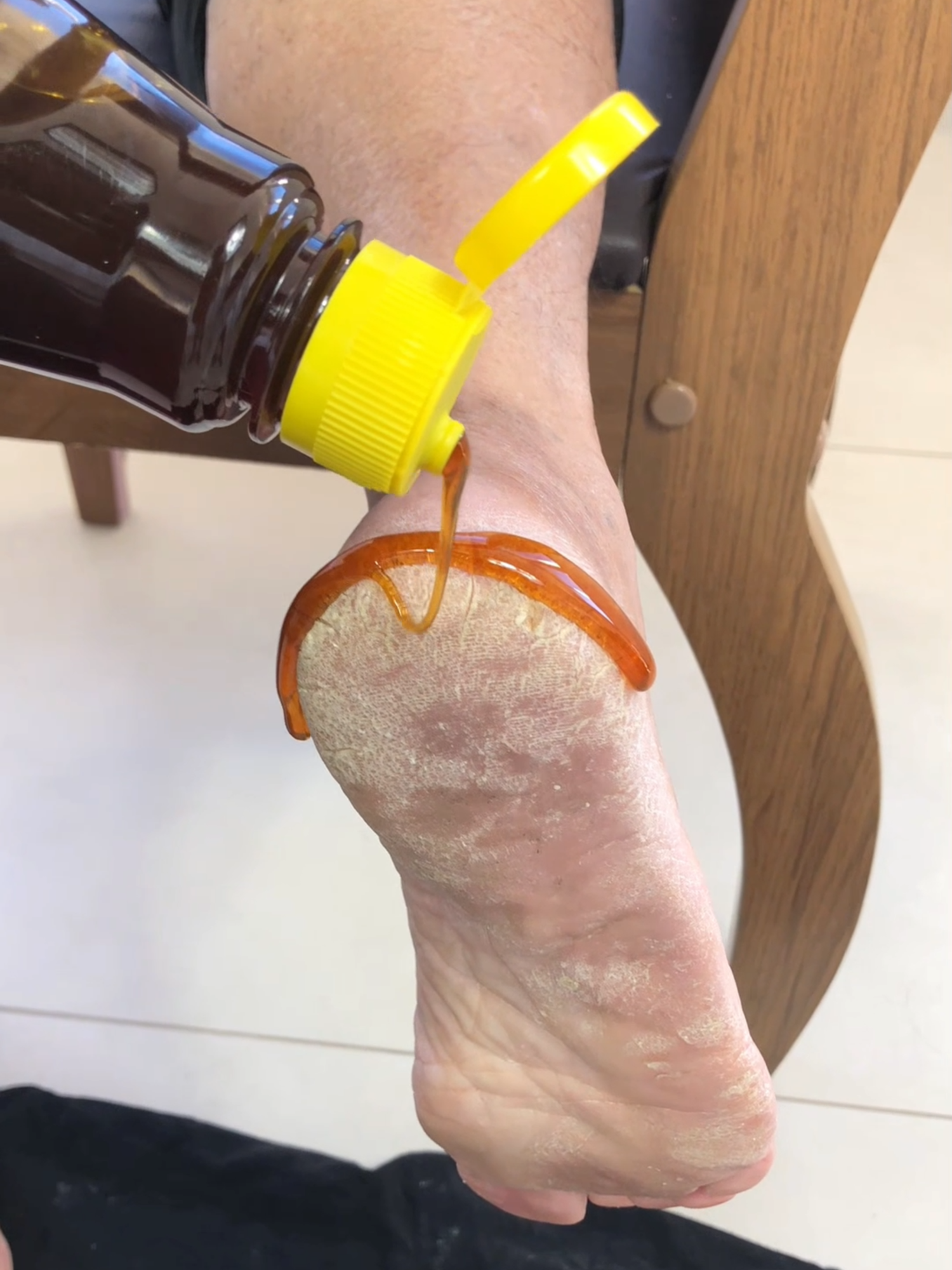 Put honey on your feet and the next day you won't believe the results! #feet #LifeHack