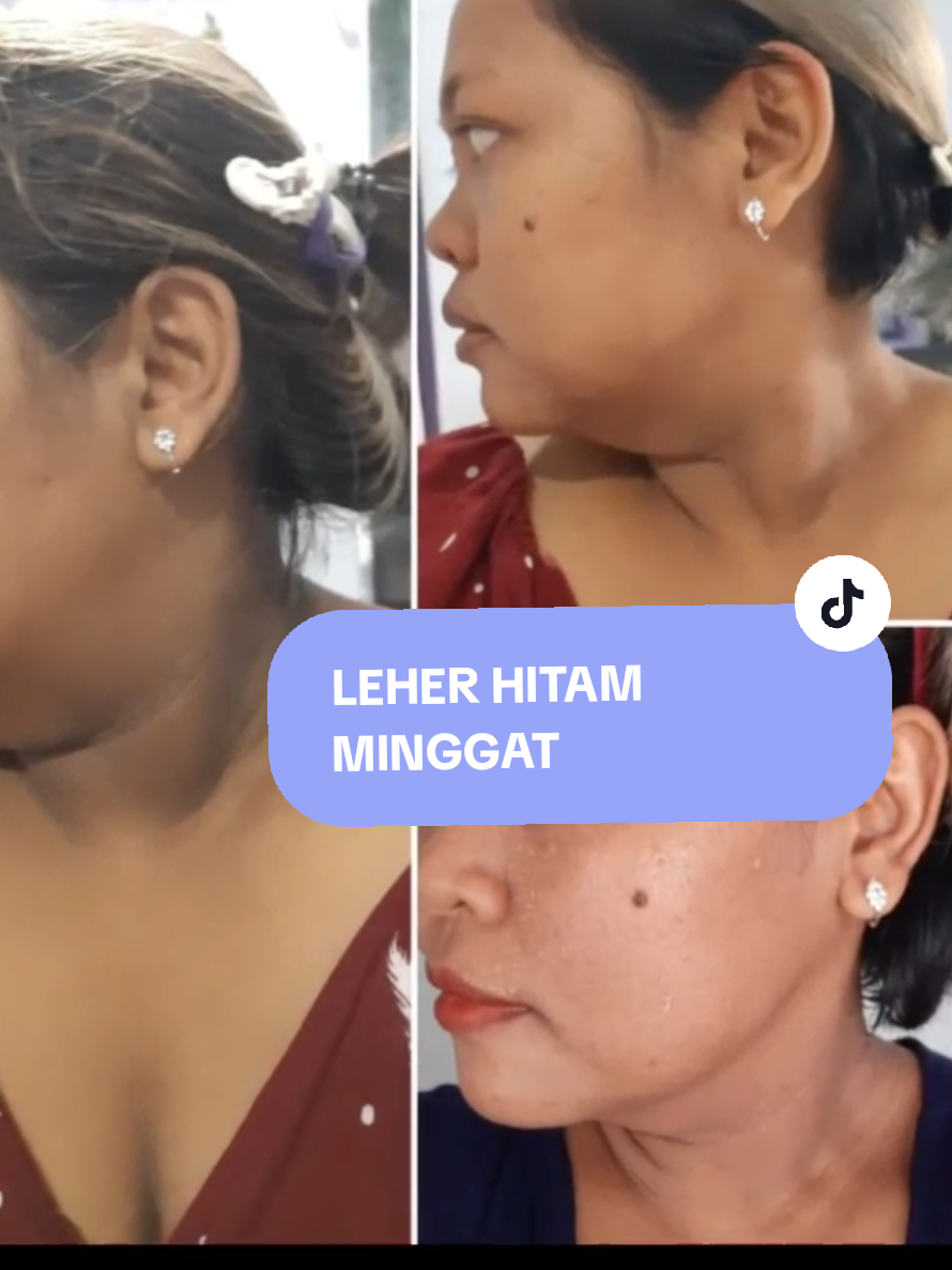 PLISSS... KLEAN KUDUUU PUNYAA.. JAN SAMPE NYESEEELLL 😭😭😭 #glycore #glycore10% #glycorecream #pencerahleher #pencerahketiak 