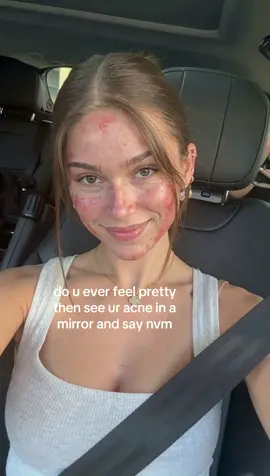 #skincare #skincareroutine #acne 