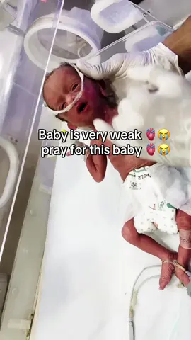 #nicubaby #please #support #ttiktok tem viral vedio #nicubabyawarness 
