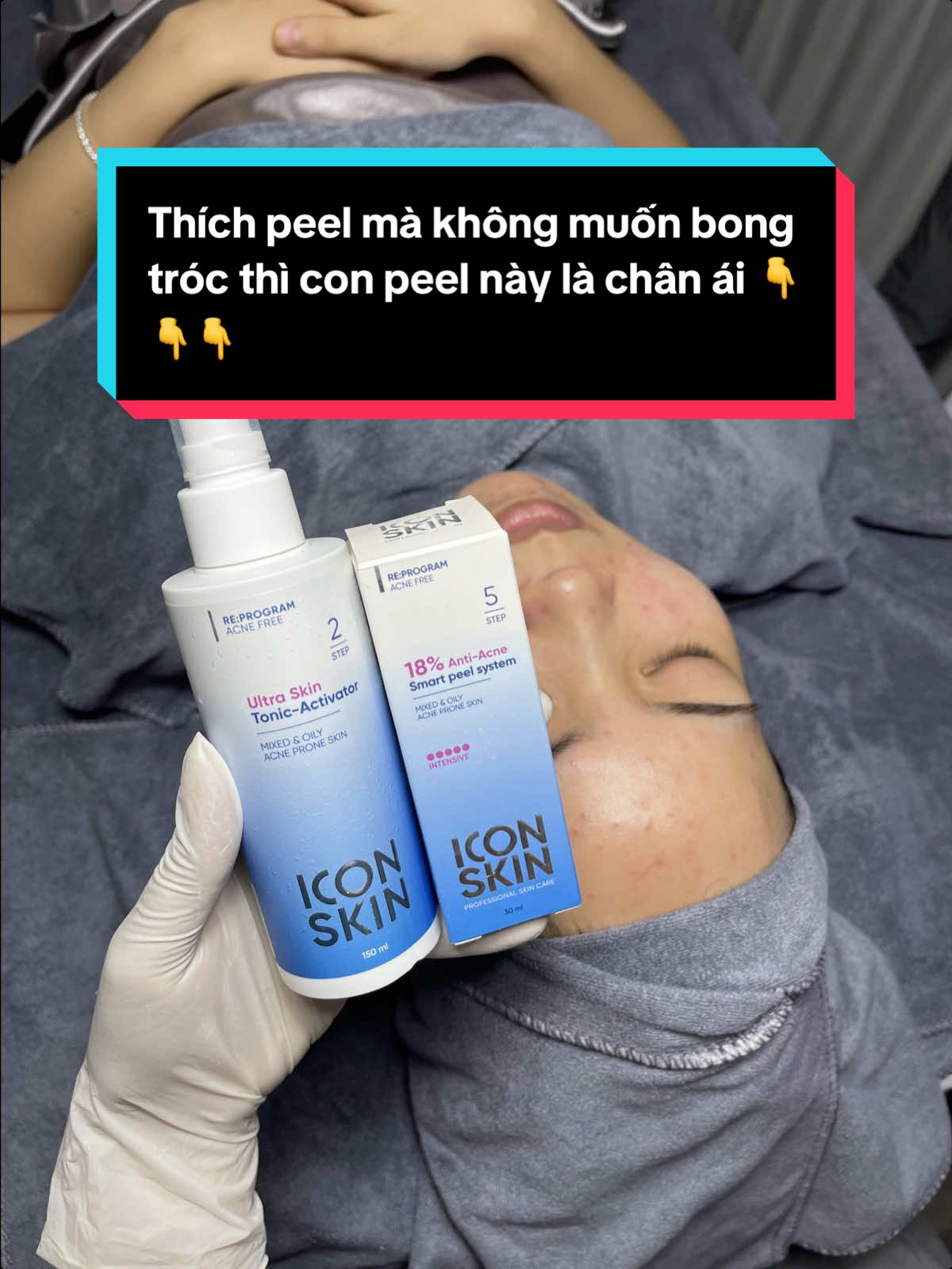 ✅Công dụng nổi bật Peel ICON Skin 18% ✨Giảm mụn, kiểm soát dầu. ✨Làm mờ thâm, đều màu da. ✨Se lỗ chân lông, mịn da. ✨Giảm viêm, làm dịu da. 👉👉Peel nhẹ, không bong tróc. #norapeel #nanmuntpbacninh #nanmunchuanykhoa #spabacninh 