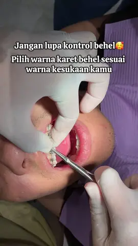 Mau hasil perawatan behel kamu maksimal? Solusinya rajin kontrol behel kamu ya🥰 #fyp #behelgigi 