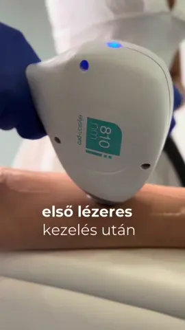 🎉 Ajándék a bérlet mellé! 🎉 Most, ha 250.000 Ft értékben bérletet vásárolsz, megajándékozunk egy Colorescience fényvédővel! ☀️✨ Védd a bőröd stílusosan – használd ki az ajánlatot, amíg tart! 💛 📍 Beauty Clinic Residnce  📅 Az akció a készlet erejéig érvényes.  #akcio #berlet #colorescience #fenyvedo #ajandek          