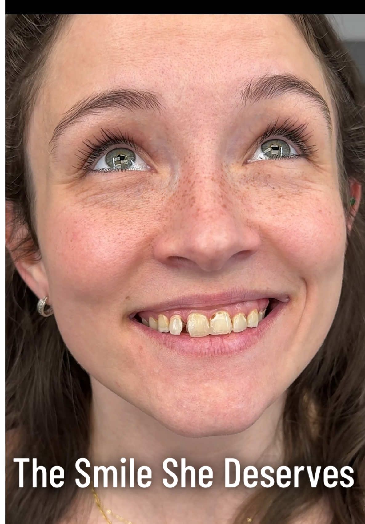 She’s only ever imagined what a perfect smile would look like… now she’s experiencing it for herself #dentist #fyp #drkenny #drkennysmiles #makeover 