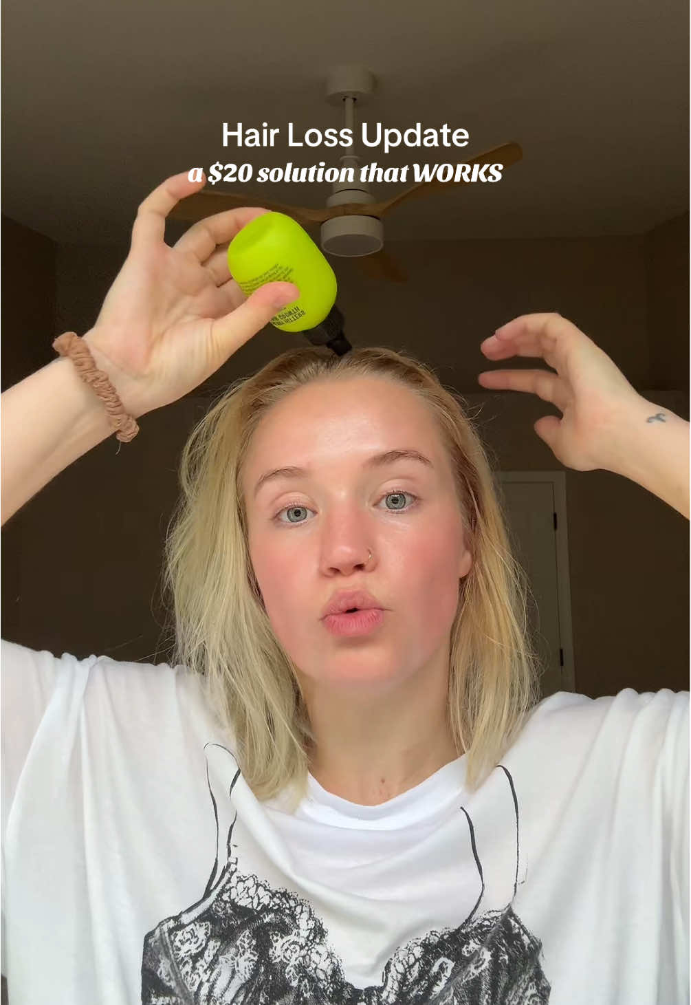 the results are in and California Naturals Re:GROW Hair Serum WORKS. it hasn’t even been that long and my hair already feels better and is shedding less. how is this only $20!!? #hairgrowthjourney #hairlosssolutions #hairgrowthtips #postpartumhairloss 