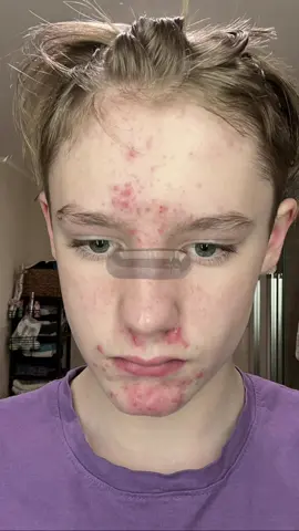 first two pics were 1,5-1 year ago and the other ones 3-4 months good ascension so far? #SelfImprovement #beauty #fyp #viral #bp 