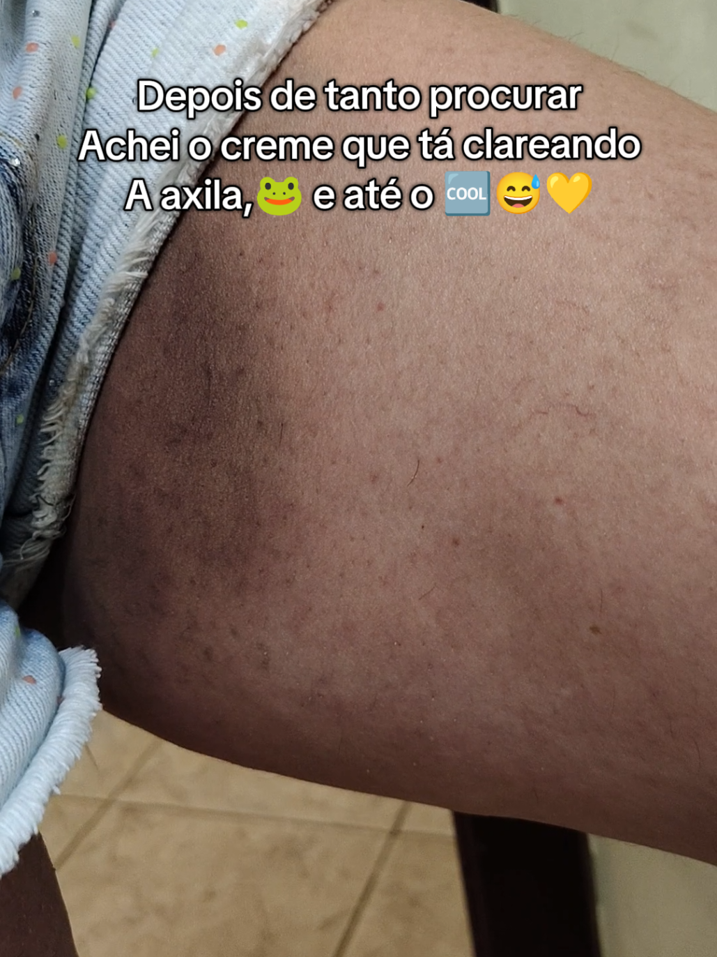 Amigas,preciso compartilhar essa descoberta com vocês🤌🏻🥹💛 #clareadordemanchas #clareador #fyp #manchas #autoestima #viraltiktok #axilas 