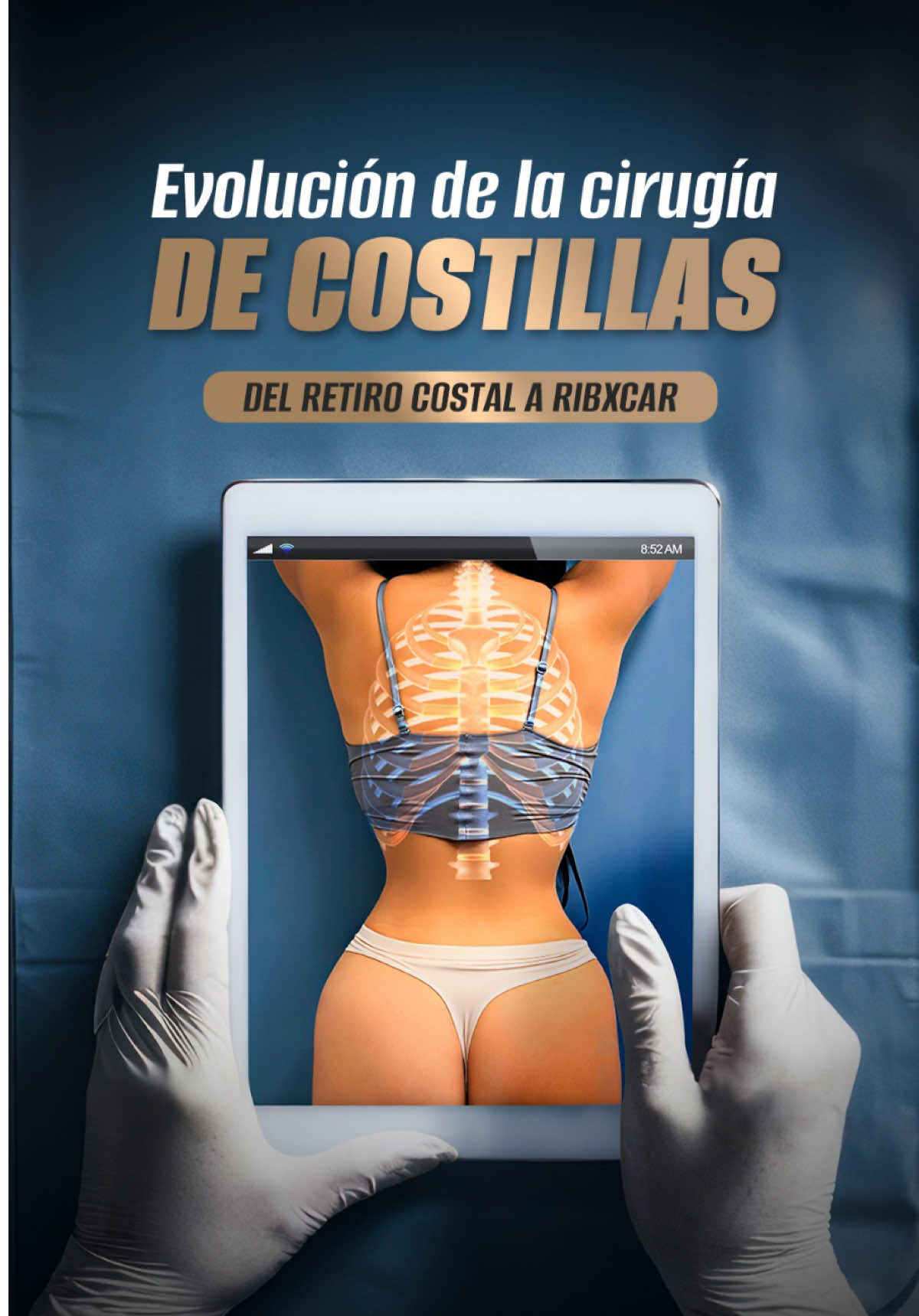 ¿Sabías que la cirugía de costillas ha evolucionado hasta alcanzar su forma más avanzada? 🧬 El Dr. Raúl Manzaneda 👨‍⚕️ te explica cómo se pasó del retiro costal, a la remodelación costal hasta llegar a #RibXcar, la técnica más revolucionaria, precisa y sin cicatrices. Menos invasiva y con resultados superiores. La nueva era de la #CirugíaAvanzada está aquí. 💎
