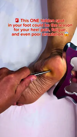 Most people don’t know that your feet are a map of your entire body. Pressing and releasing this exact acupoint can: ✅ Relieve heel & plantar fasciitis pain ✅ Improve blood circulation & lymphatic drainage ✅ Detox your body by stimulating liver & kidney meridians ✅ Restore energy flow and reduce inflammation This is why foot reflexology and acupoint therapy are in such high demand—because results are instant and impact the whole body, not just the feet. #FootReflexology #HeelPainRelief #PlantarFasciitis #FootMassage #MeridianHealing #CirculationBoost #DetoxYourBody #KinesiologyMassage #EnergyHealing #PainFreeLiving #HolisticHealth #AcupressurePoints