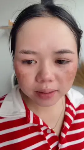 #ครีมกิมจิ #ครีมกิมจิแก้ฝ้า #สินค้าพร้อมส่ง #รีวิวบิวตี้ 