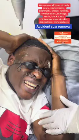 #kampala_tiktokers #foryoupage❤️❤️ #kampala_uganda🇺🇬🇺🇬🤝 #alienskinug😂🔥🔥 #sudantiktok🇸🇩 