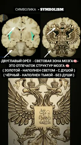 СССР🌞 vs МОЗГ🧠 ( ДУШЕВНО - РАДУШИЕ )#ссср #symbol #советскийсоюз #мозг #свет 