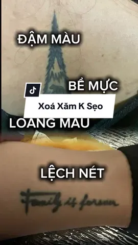 Nếu bạn đang muốn xoá đi hình xăm. Mà lo sợ sẹo, không mờ, tốn kém. Thì IB JangMi tư vấn nha ✅ Bác sĩ da liễu trực tiếp làm thì sẹo k có cửa xuất hiện  #xoaxam #sangda #motham #jangmiclinic #pov 