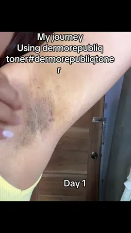 Dermorepubliq Toner 7% Glycolic Acid (AHA) Skin Renewing Solution #dermorepubliqtoner #dermorepubliq #glycolicacid #underarmwhitening 