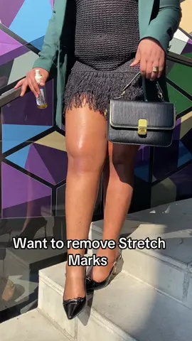 #stretchmarks #stretchmarksolution #skincare #fyp #skincaretips 