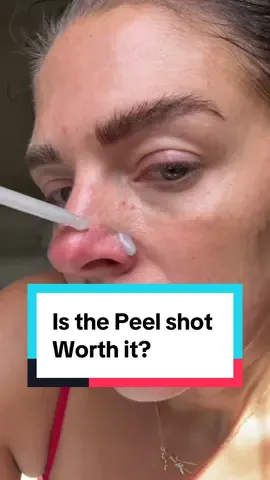 White rice serum should be used on more delicate areas such as your face & neck. The black rice serum is perfect for more rough and bumpy areas! Both are perfect prulled out sensitive skin, no burning! in SECONDS! #drmelaxin #peelshot #exfoliate #drmelaxinpeelshot #blackheads @Dr.Melaxin Global 