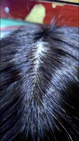 skin base available  #wiginstall #hair #tiktokviral #foryoupage #foryou 