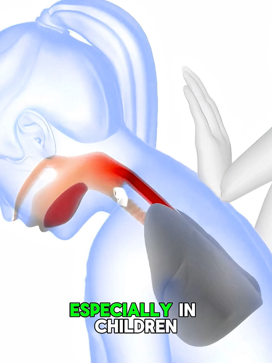 Choking First Aid – Save a Life in Seconds! (Medical 3D Animation)🚨 #ChokingFirstAid #FirstAid #SaveLives #EmergencyResponse #CPR     