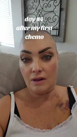 day #4 after my first chemo infusion.  I feel overall good,  just dealing with headache,  and fatigue mostly.  But, about your appetite today🤦‍♀️ I'M STARVING!!! #cancer #cancertok #lupus #cancersurvivor 