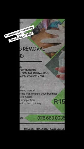 #Polokwane #fyp #polokwanetiktoker #polokwanetiktok🇿🇦🇿🇦🇿🇦 #skintagremoval 