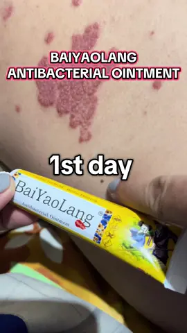 #baiyaolang #skinproblem #baiyaolangointment #baiyaolangcream #baiyaolangreview 