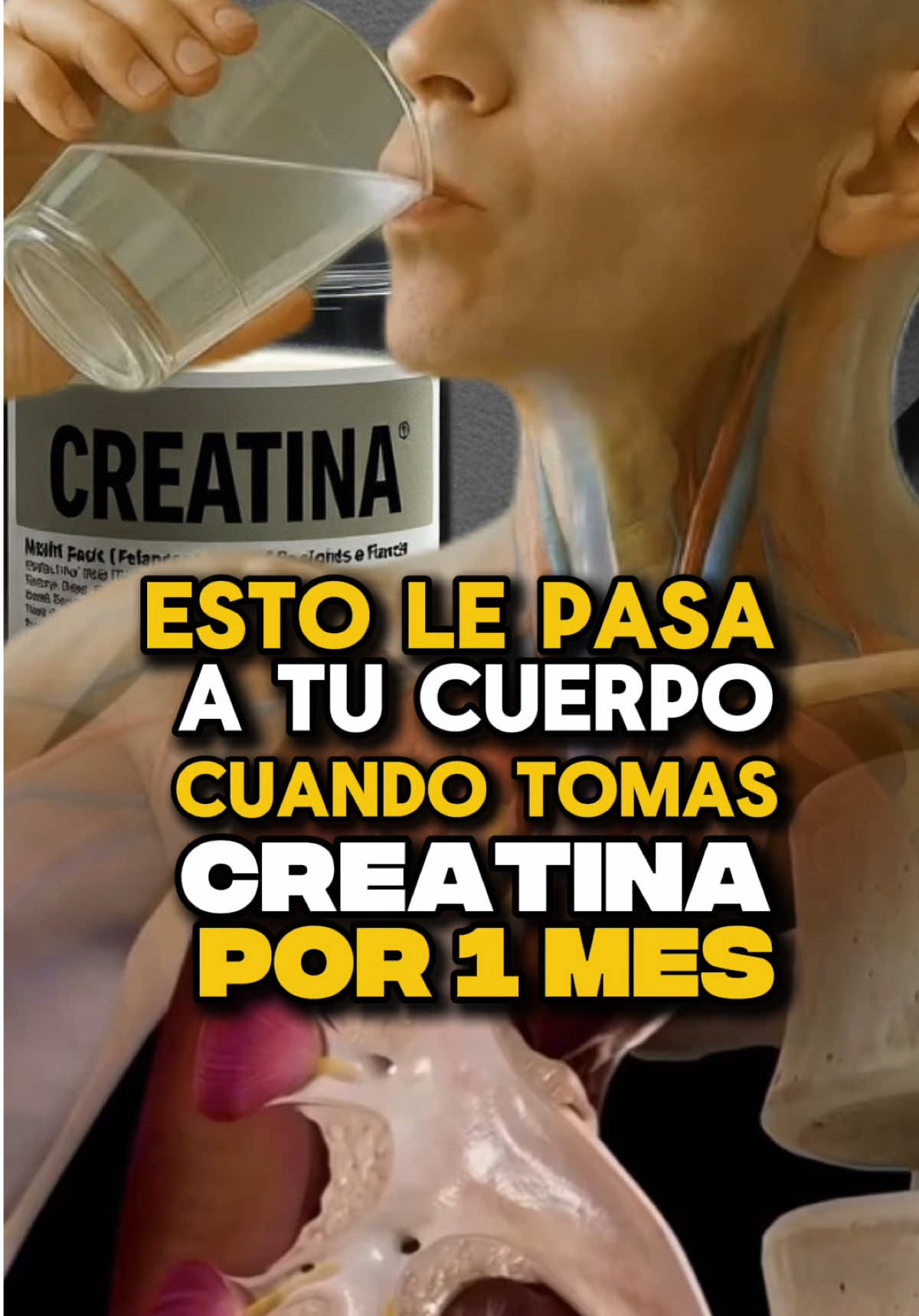ESTO PASA CUANDO TOMAS CREATINA POR UN MES – La creatina es un suplemento respaldado por evidencia científica sólida y, hasta la fecha, no se han reportado efectos secundarios significativos. Este suplemento seguro cuenta con numerosos estudios que avalan su eficacia, por lo que definitivamente puede ser un aporte valioso en tu entrenamiento. Sin embargo, es importante comprender su funcionamiento para optimizar sus beneficios; no se trata de “tomar por tomar”. Existe un proceso específico que permite que la creatina se acumule adecuadamente en el organismo, y en este video te explico exactamente qué ocurre cuando la consumes durante un mes. 🏆✅💪🏽 #creatina #creatinamonohidrato #madroking #MétodoMadroking #coachmadroking 