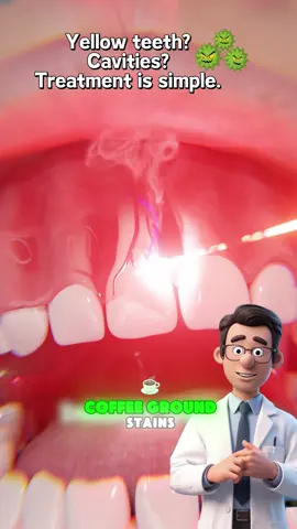 How To Get The Whitest Teeth In The World! 😬🦷   #Bodyaccel#TeethWhitening#TikTok ShopLaborDaySale #dealsforyouday#TikTokShopBacktoSchool