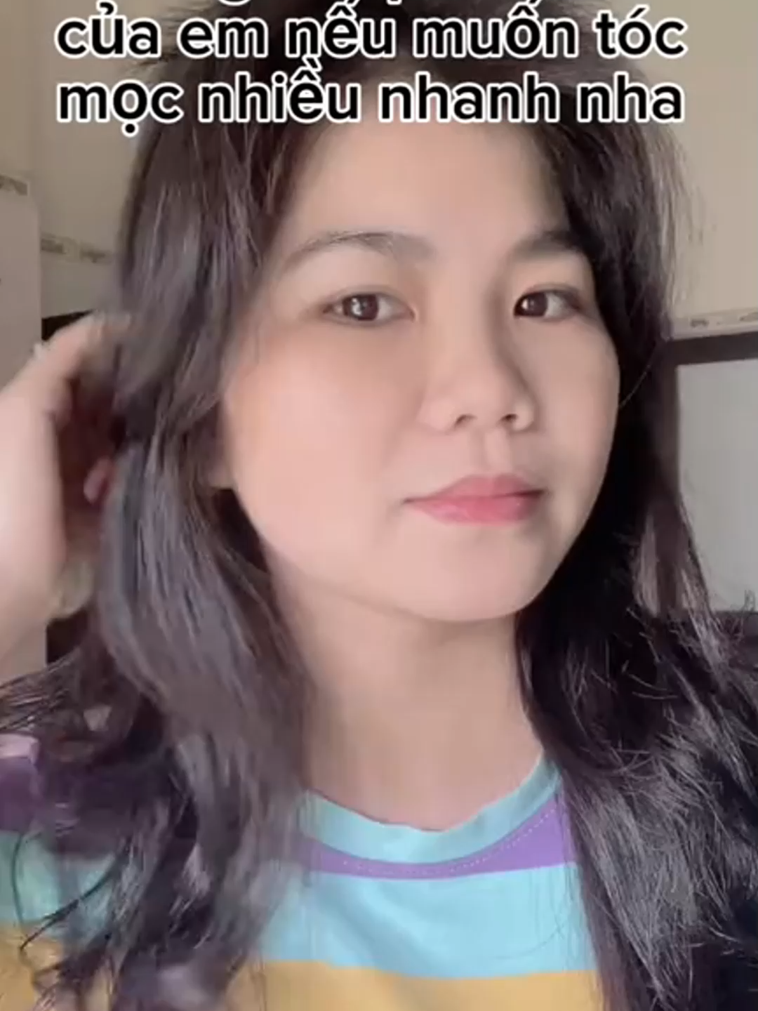 Bạn có biết? Rụng tóc quá mức có thể dẫn đến hói đầu vĩnh viễn nếu không được điều trị kịp thời. Liên hệ với chúng tôi ngay để được tư vấn! #toc #rungtoc #hoidau #moctoc #kichmoctoc #hair #haircare #hairloss