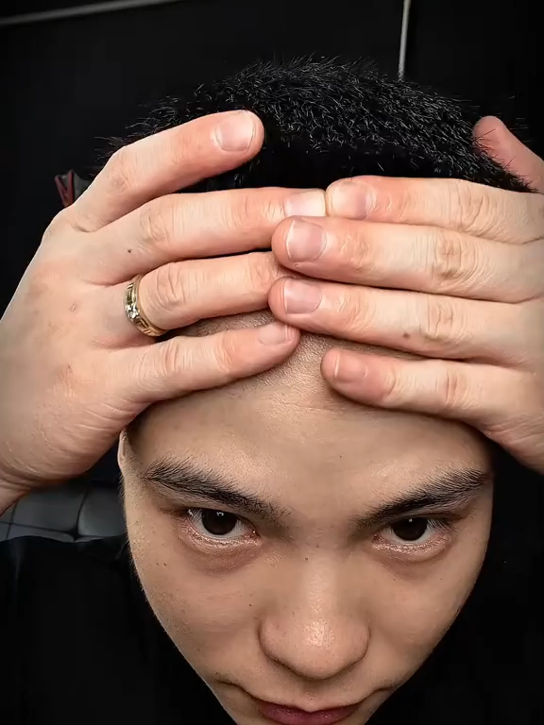 Bạn có biết? Rụng tóc quá mức có thể dẫn đến hói đầu vĩnh viễn nếu không được điều trị kịp thời. Liên hệ với chúng tôi ngay để được tư vấn! #toc #rungtoc #hoidau #moctoc #kichmoctoc #hair #haircare #hairloss