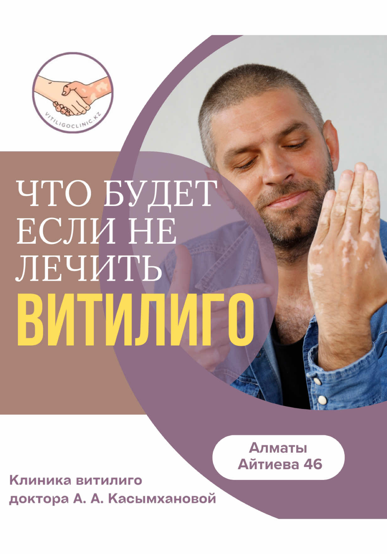 ВИТИЛИГО НЕ ПРИГОВОР! Спасибо что выбираете нас и доверяете свое здоровье, будьте здоровы! @vitiligoclinik.kz 📍Наш адрес: Казахстан город Алматы улица Айтиева 46 ☎️+7(707)7474217 📩также можете писать в директ  💞С заботой о Вас «Клиника витилиго доктора А.А. Касымхановой» #витилиго#лечениевитилиго#витилигонеприговор#псориаз#лечениехирургическимпутем#фототерапия#дерматолог#лечимвитилиго#ремиссия#дерма#витилиголечим# #creatorsearchinsights 