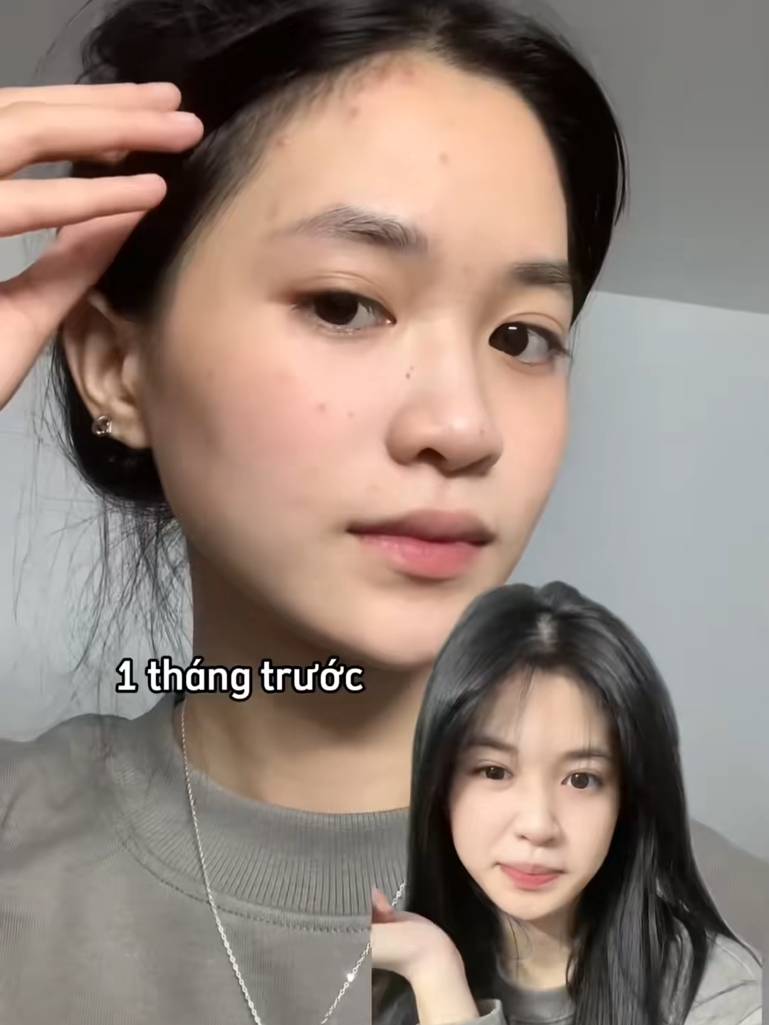 Sữa rửa mặt i, sạch mụn, sáng da, mờ thâm. giá chỉ 99kkkk / 1 chai sắm cho mình một chai đi đảm bảo ưng cái bụng luôn.. #suaruamat #sachmun #skincare