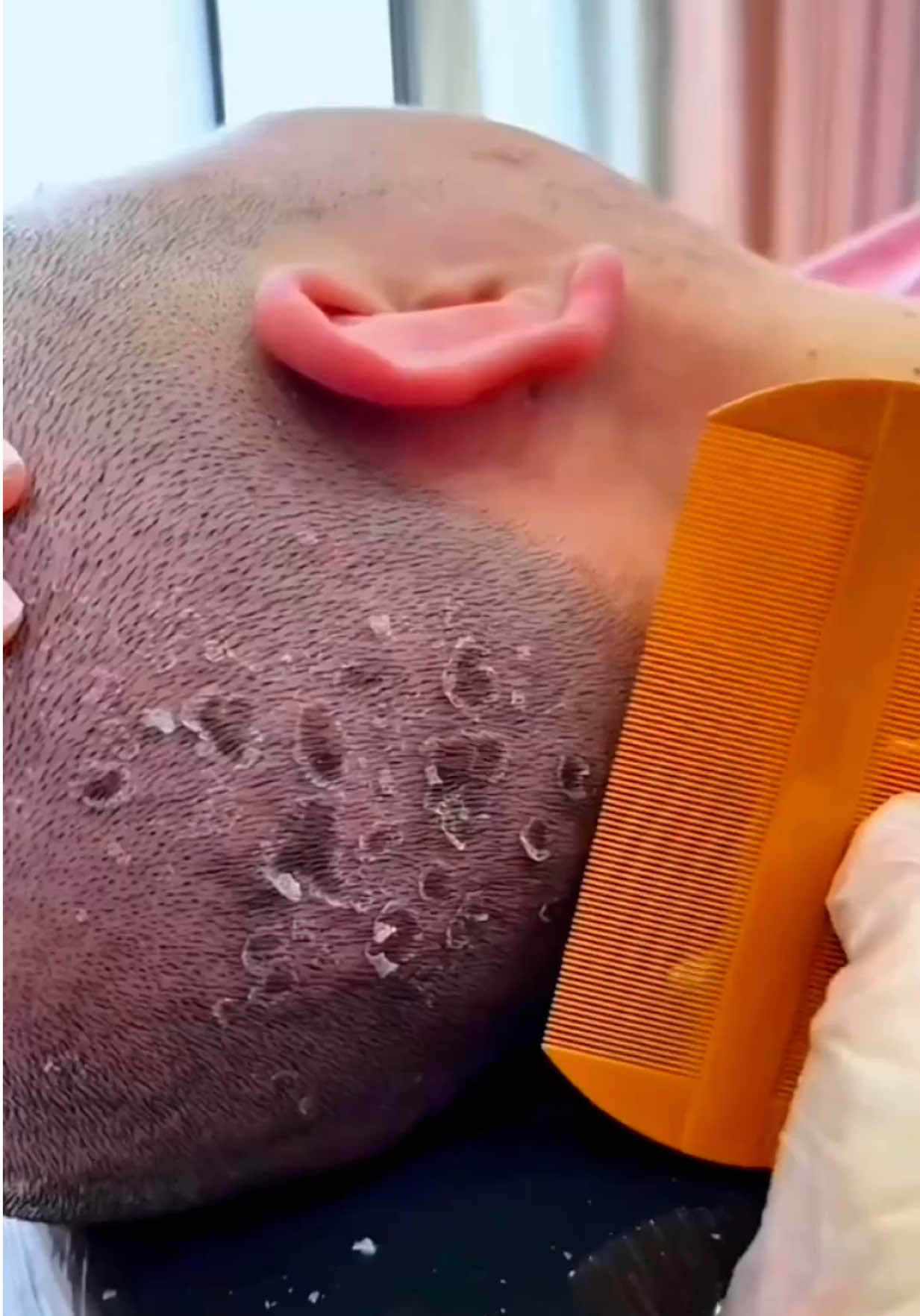 Dầu Gội Sạch Gàu Antisol iCare #shockreview #trikhang #daugoitrigau #daugoinamnung #daugoiicare 