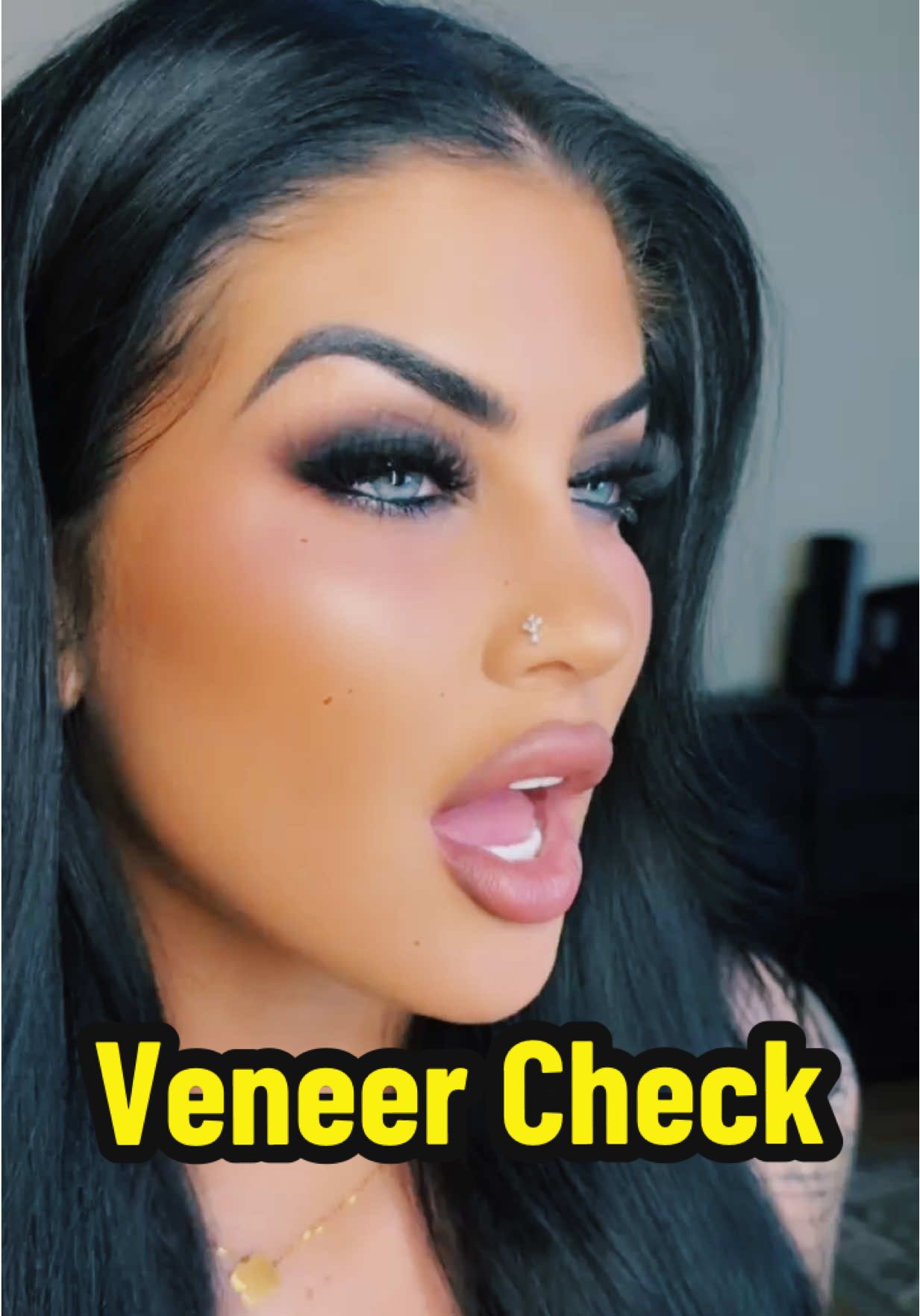 Website for custom veneers in my bio. Discount code TSV80 removes $80. #fyp #veneers #newsmile #cliponveneers #foryoupage @TruSmile Veneers 